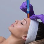 skin-by-karoly-microneedling-healthcare-hythe-kent